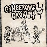 Cancerous Growth - Cancer Causing Agents Cancerou